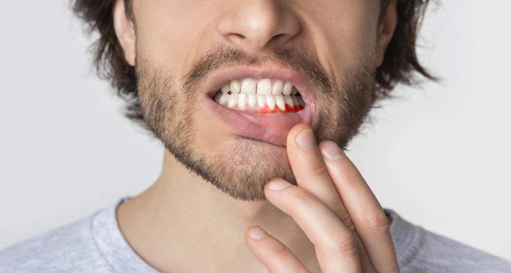 Periodontia Tatuapé